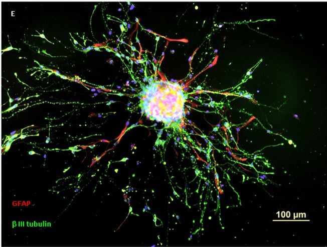 Reversal of the parental neurobehavioral teratogenicity